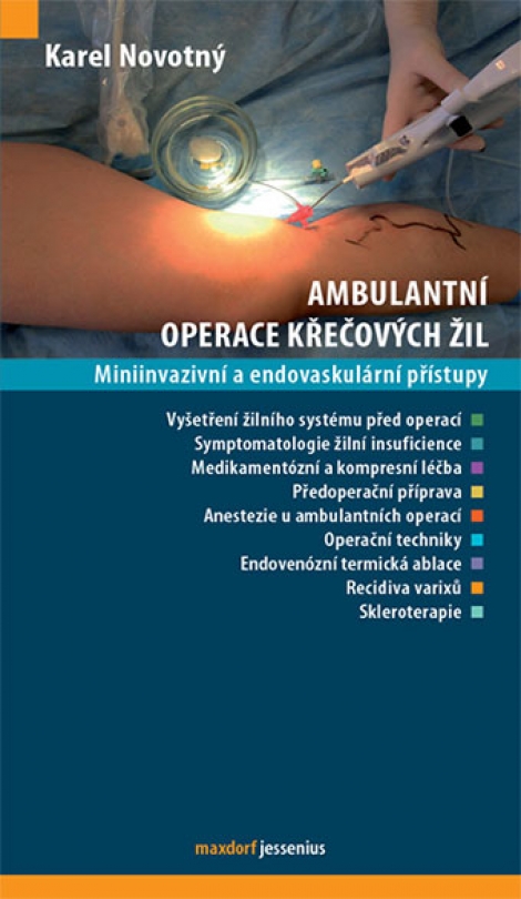 Ambulantní operace křečových žil - Miniinvazivní a endovaskulární přístupy