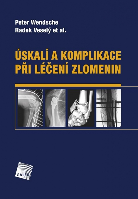 Úskalí a komplikace při léčení zlomenin - 