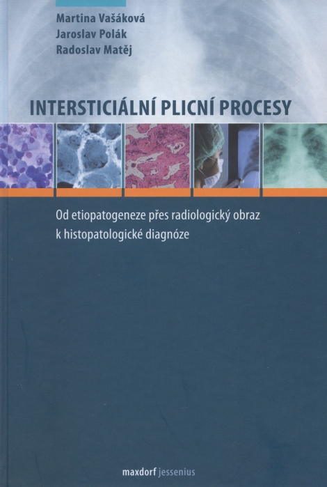 Intersticiální plicní procesy - Od etiopatogeneze přes radiologický obraz k histopatologické diagnóze