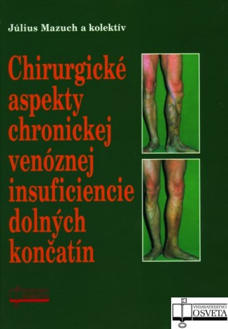 Chirurgické aspekty chronickej venóznej insuficiencie dolných končatín - 