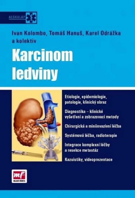 Karcinom ledviny + DVD - 