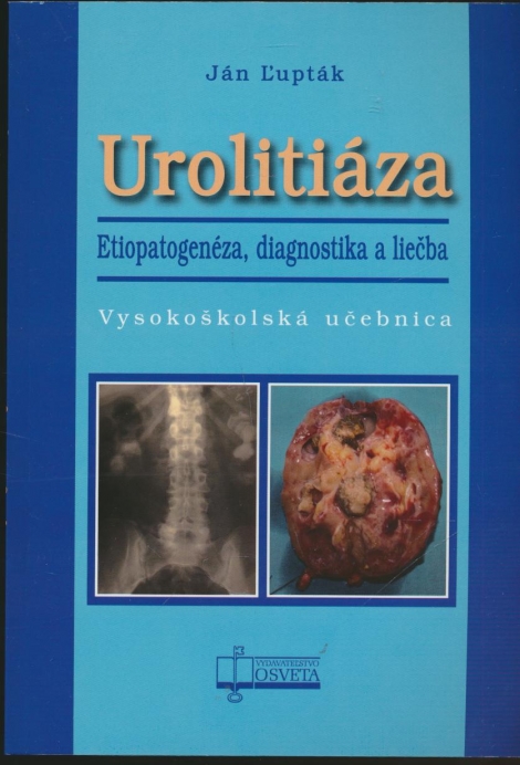 Urolitiáza. Etiopatogenéza, diagnostika a liečba - 
