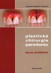 Plastická chirurgie parodontu - 