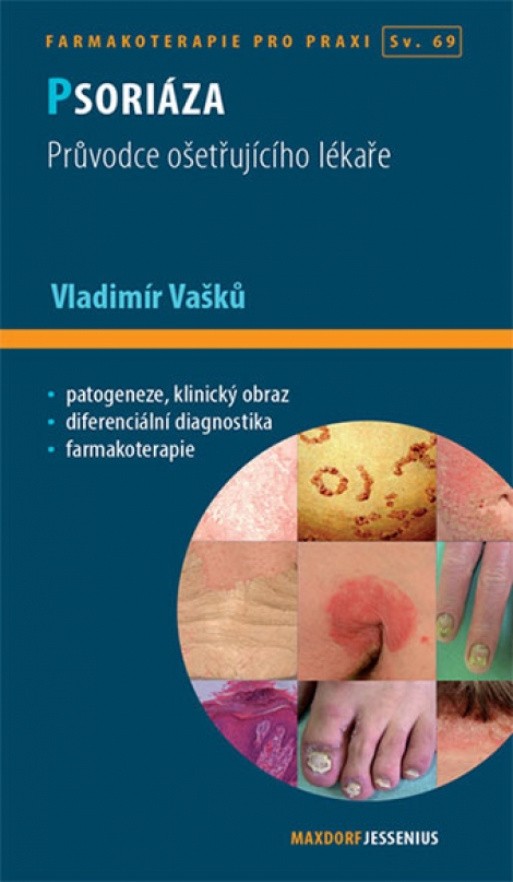Psoriáza - Farmakoterapie pro praxi / Sv. 69