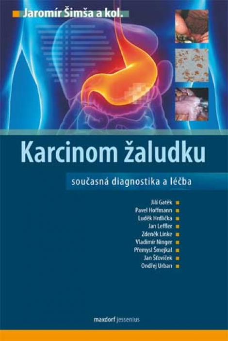 Karcinom žaludku - Současná diagnostika a léčba