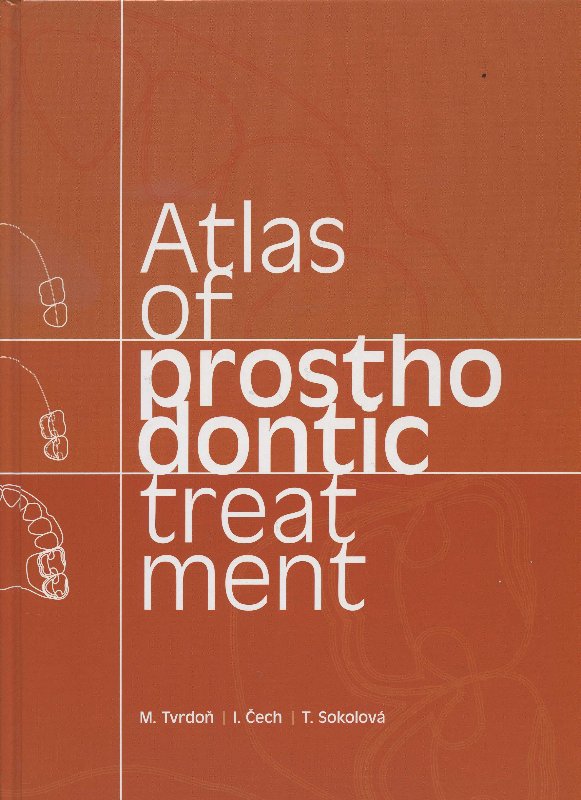 Atlas of prosthodontic treatment