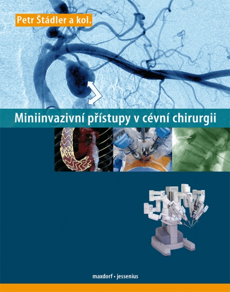 Miniinvazivní přístupy v cévní chirurgii - 