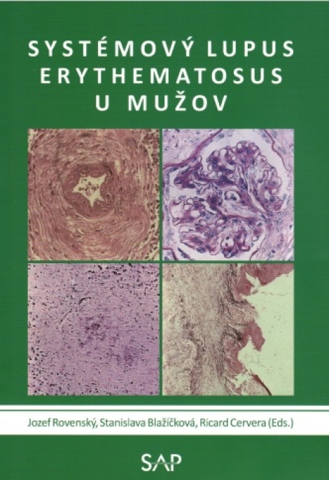 Systemovy lupus erythematosus u muzov - 
