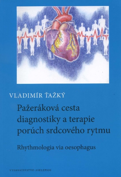 Pažeráková cesta diagnostiky a terapie porúch srdcového rytmu - Vladimír Ťažký