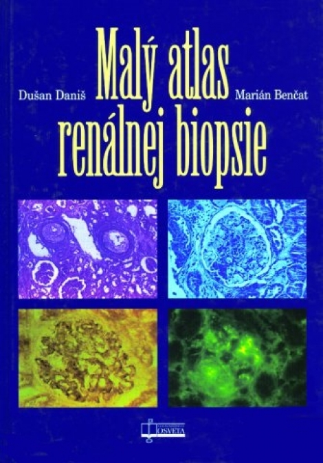 Malý atlas renálnej biopsie - 