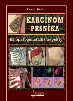 Karcinóm prsníka - Etiopatogenetické aspekty
