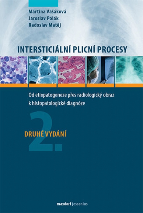 Intersticiální plicní procesy, 2.vydání - Od etiopatogeneze přes radiologický obraz k histopatologické diagnóze