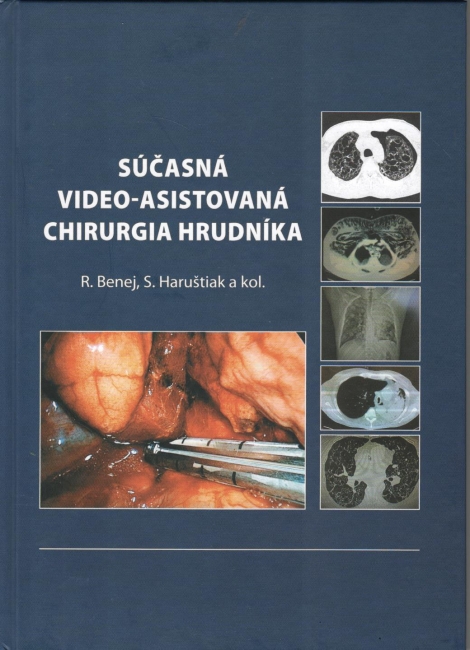 Súčasná video-asistovaná chirurgia hrudníka - Roman Benej, Svetozár Haruštiak