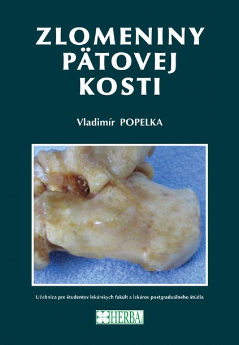 Zlomeniny pätovej kosti - 