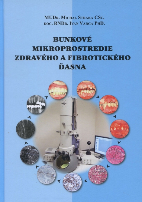 Bunkové mikroprostredie zdravého a fibrotického ďasna - Michal Straka, Ivan Varga