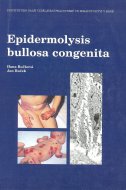 Epidermolysis bullosa congenita - 