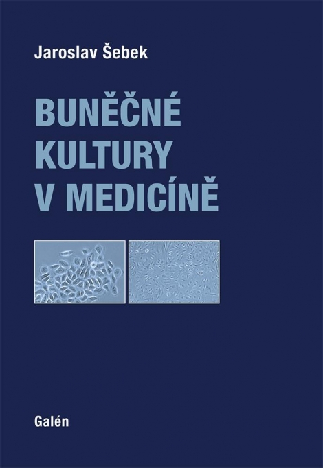 Buněčné kultury v medicíně - 