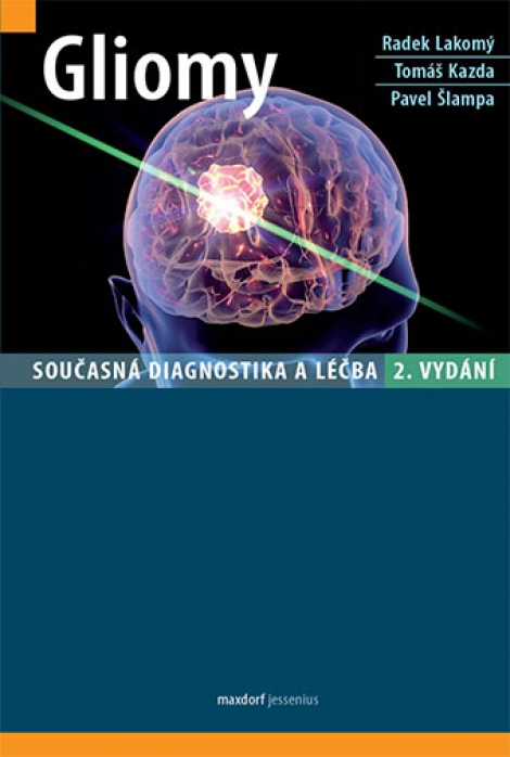 Gliomy (2. vydání) - Současná diagnostika a léčba