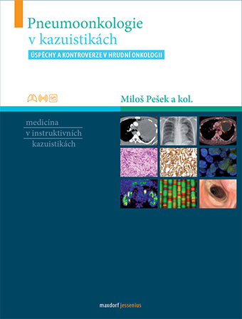 Pneumoonkologie v kazuistikách - 