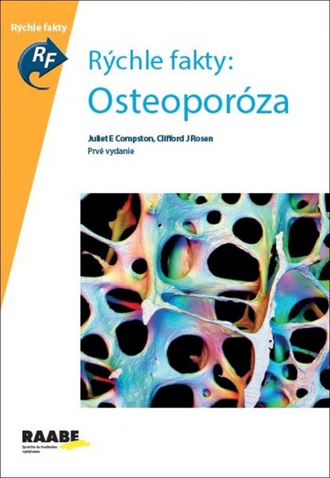 Rýchle fakty: Osteoporóza (Prvé vydanie) - 