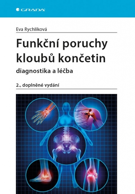 Funkční poruchy kloubů končetin (2., doplněné vydání) - diagnostika a léčba
