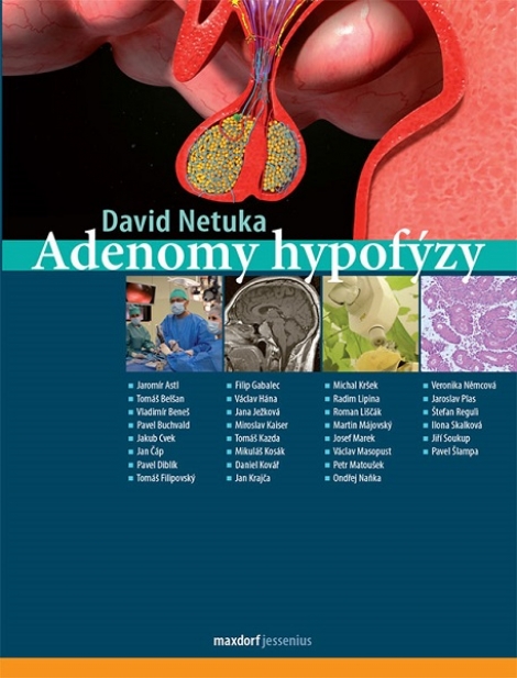 Adenomy hypofýzy - 