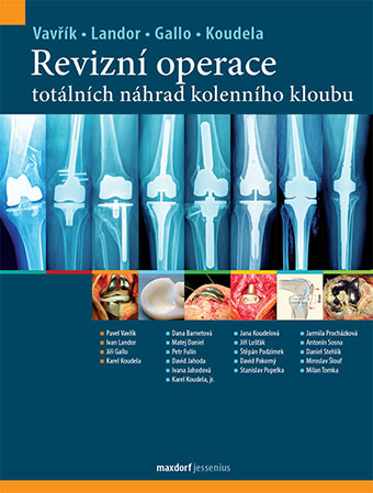 Revizní operace totálních náhrad kolenního kloubu - 
