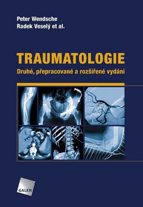 Traumatologie (Druhé, přepracované a rozšířené vydání) - 