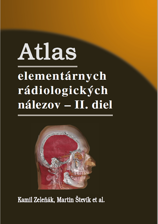 Atlas elementárnych rádiologických nálezov - II. diel - 