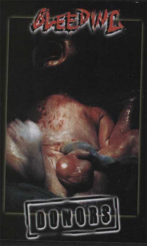 Bleeding - Bleeding