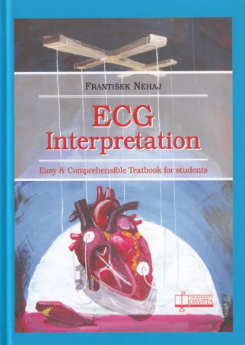 ECG  - Interpretation - 