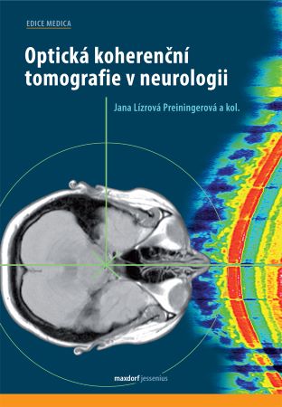 Optická koherenční tomografie v neurologii - 