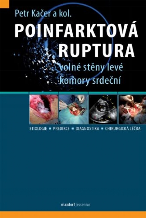 Poinfarktová ruptura volné stěny levé komory srdeční - 