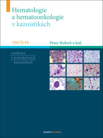 Hematologie a hematoonkologie v kazuistikách - Medicína v instruktivních kazuistikách