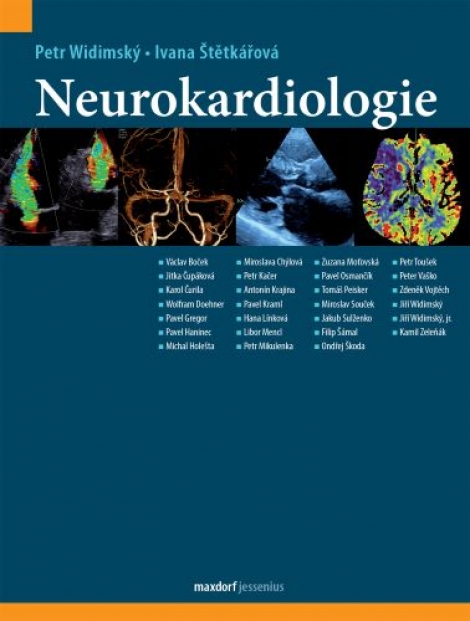 Neurokardiologie - 