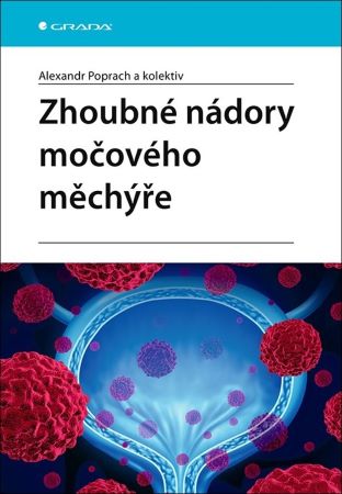 Zhoubné nádory močového měchýře - 