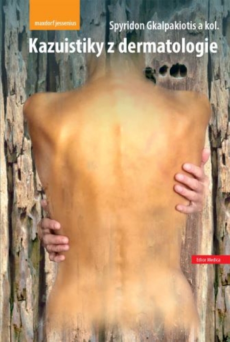 Kazuistiky z dermatologie - 