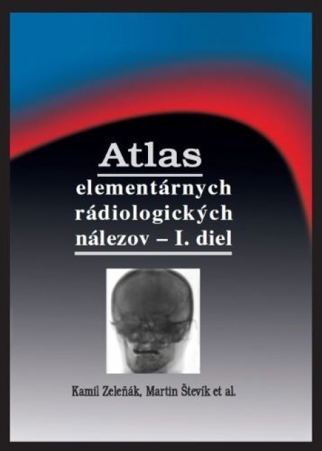 Atlas elementárnych rádiologických nálezov - I. diel (2.vydanie) - 