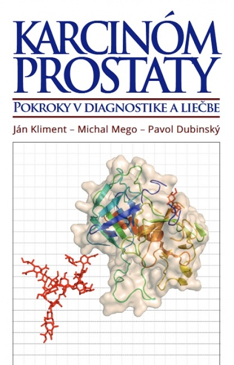 Karcinóm prostaty - Pokroky v diagnostike a liečbe