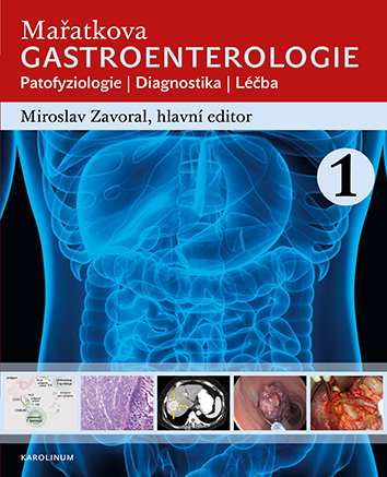 Mařatkova gastroenterologie - Patofyziologie, Diagnostika, Léčba (komplet)