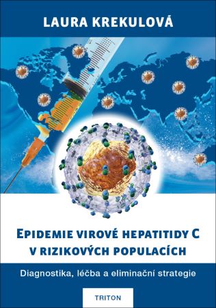 Epidemie virové hepatitidy C v rizikových populací - Diagnostika, léčba a eliminační strategie