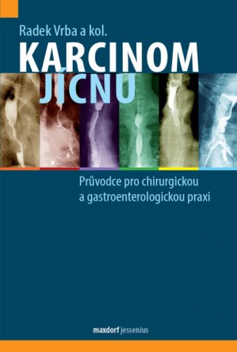 Karcinom jícnu - 