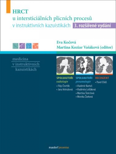 HRCT u intersticiálních plicních procesů v instruktivních kazuistikách (3. rozšířené vydání) - 