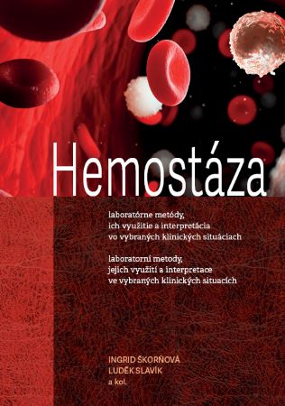 Hemostáza - laboratorní metody, jejich využití a interpretace ve vybraných klinických situacích