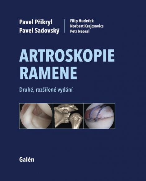 Artroskopie ramene (Druhé, rozšířené vydání) - 