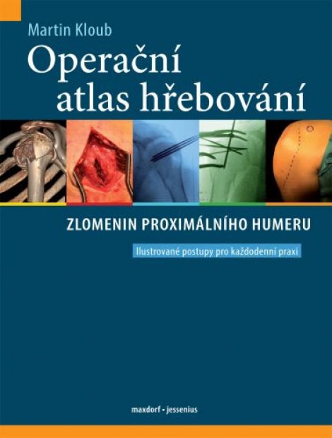 Operační atlas hřebování zlomenin proximálního humeru - 