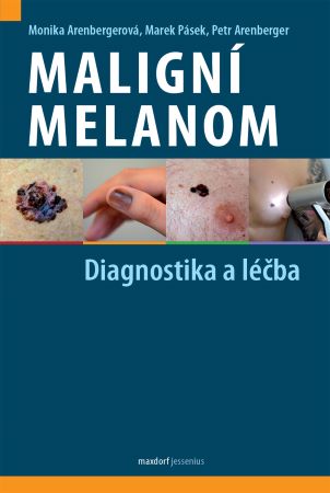 Maligní melanom - Diagnostika a léčba