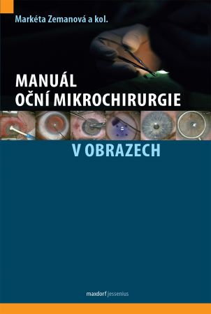 Manuál oční mikrochirurgie v obrazech