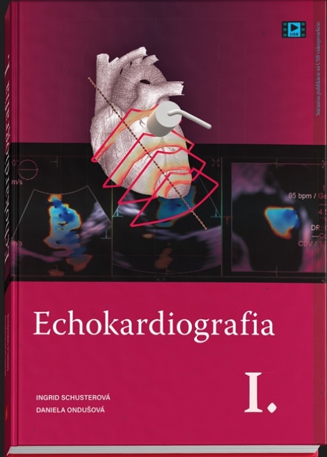 Echokardiografia I. - 