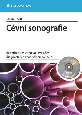 Cévní sonografie - Repetitorium ultrazvukové cévní diagnostiky a atlas nálezů na DVD